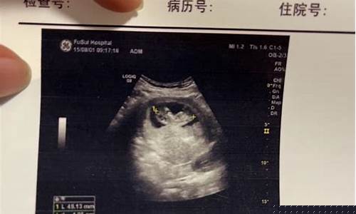 胎儿健康检查时应该注意什么？