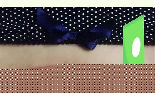剖腹产后的伤口如何护理？