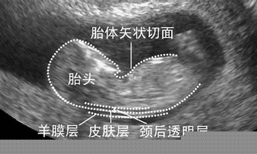 胎儿畸形的早期检查方法是什么？